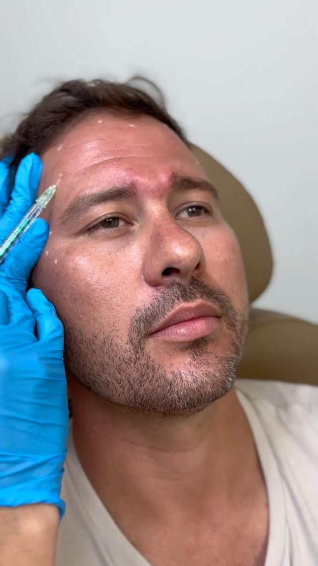 Snap your fingers for Brotox!🫰💉

Did you know that if you’re apart of Rejuvime’s VIP program, you and your spouse receive a 15% discount on Botox and Filler!!🤩🤩 

Come and get started today! 💪🏼💉

#Rejuvime #Louisiana #botox #brotox #wrinkles #agedefying #filler #byebyewrinkles #injections #injectibles #allerganbotox #VIP