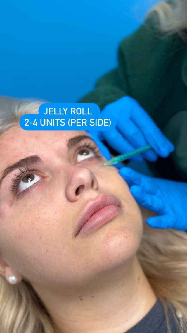 Did you know that we offer Botox and Filler for 15% off if you’re apart of our VIP program?! 💸💉

Call the office today to get started!🤩

#Rejuvime #botox #filler #discounts #VIP #program #aging #cosmetics #injectables #injectables #cosmetictherapy #botoxinjectjons #byebyewrinkles